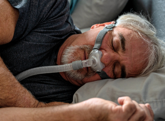 CPAP (presión positiva continua en las vías respiratorias) para la apnea del sueño: ¿cuáles son sus efectos secundarios?