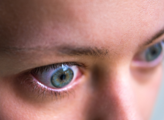 Oftalmopatía tiroidea: cuando la mirada se convierte en el reflejo de la enfermedad